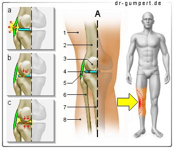 Schematische Darstellung Knieschmerzen außen