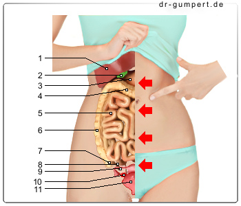 Schematische Darstellung von Bauchschmerzen auf der rechten Seite