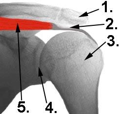 Rotatorenmanschette
