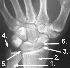 Handwurzelknochen und Handgelenk im Röntgen