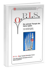 Buch Hallux Rigidus