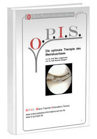 Buch Meniskusriss