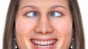 image: Schielen