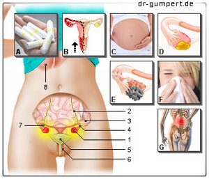 Schamlippe einseitig kleine geschwollen Schmerzen an