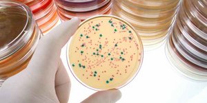Petrischale mit Bakteriumwachstum