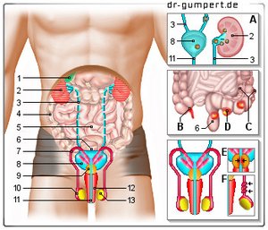 Abbildung von Ursachen von Schmerzen im Unterleib beim Mann