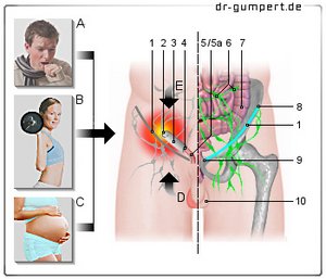 https://www.dr-gumpert.de/fileadmin/_processed_/4/7/csm_Schmerzen_Leiste_e2beda68d1.jpg