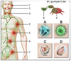 Kinn lymphknoten geschwollen unterm Lymphknotenschwellung am