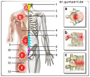 Abbildung Rückenschmerzen