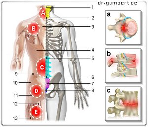 Das Training den Hals bei der Osteochondrose