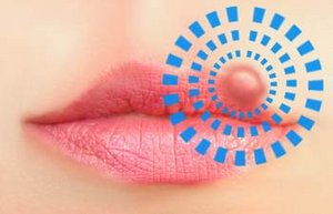 Medikamente Lippenherpes