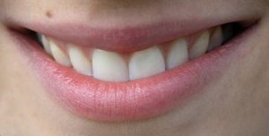 Rand entzündete lippen roter Nebenwirkungen: Rund