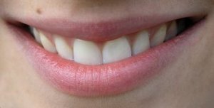 Entzündete lippen roter rand