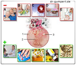 Abbildung Hautausschlag nach Antibiotikaeinnahme