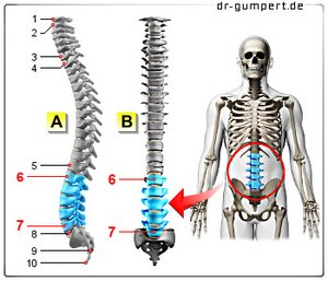 Abbildung Lendenwirbelsäule