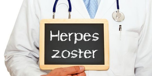 Herpes Zoster