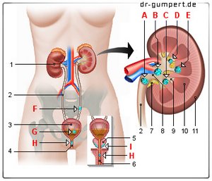 Abbildung Nierensteine