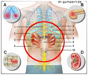 Abbildung Rückenschmerzen mittlerer Rücken