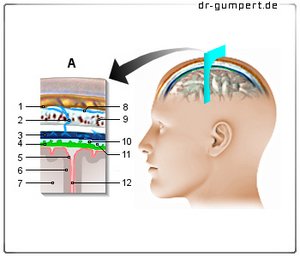 Abbildung Hirnhaut