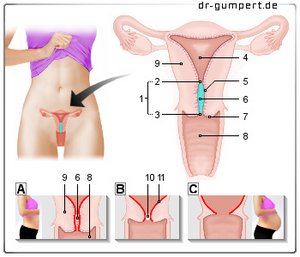 Abbildung Gebärmutterhals