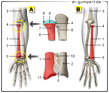 Abbildung rechter Unterarm mit Speiche