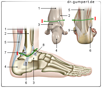 Schematische Darstellung Oberes Sprunggelenk