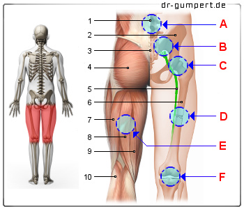 Schematische Darstellung zu Schmerzen am hinteren Oberschenkel