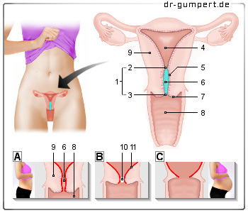 Schematische Abbildung des Gebärmutterhalses