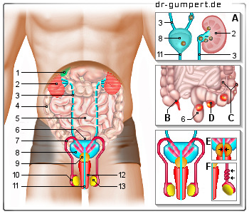 Schematische Darstellung Unterleibsschmerzen beim Mann