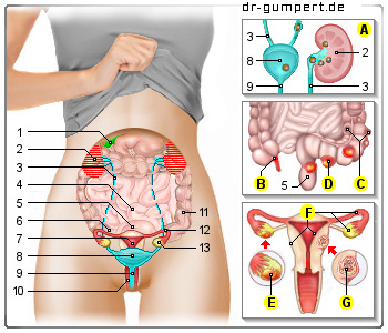 Schematische Darstellung Unterleibsschmerzen bei der Frau