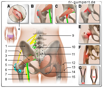 Schematische Abbildung zu Schmerzen an der Hüfte