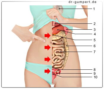 Schematische Darstellung Bauchschmerzen links