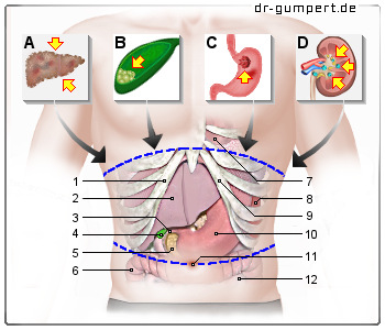 Schematische Darstellung Oberbauchschmerzen