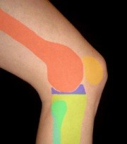 Knieschmerzen außen Abbildung Knie außen