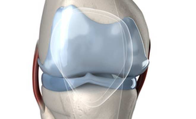 Ligamentum collaterale mediale