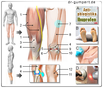 Abbildung Schmerzen oberhalb des Knies