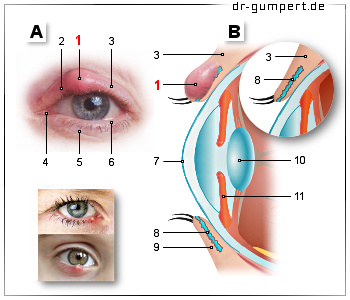 Schematische Darstellung des Gerstenkorns