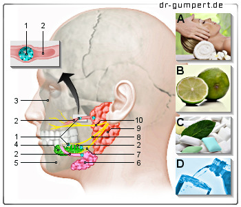 Schematische Darstellung Speichelsteine