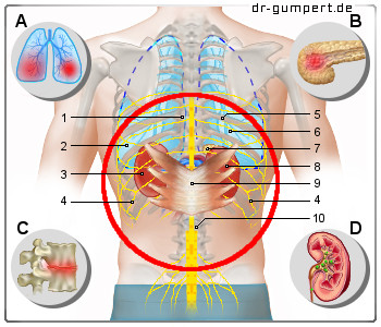 Schematische Darstellung Rückenschmerzen am mittleren Rücken