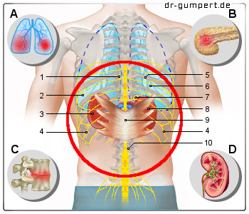 Abbildung Rückenschmerzen mittlerer Rücken