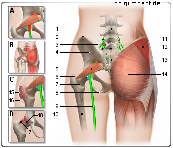 Schematische Darstellung zu Schmerzen an der Gesäßbacke