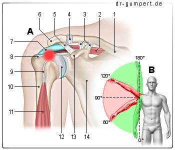 Schematische Darstellung des Impingement-Syndroms