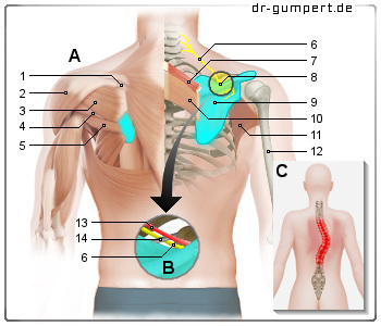 Schematische Darstellung zu Schmerzen im Schulterblatt