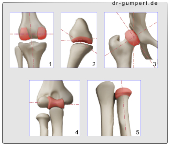 Schematische Darstellung verschiedener Gelenkformen