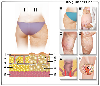 Schematische Darstellung von Bindegewebe