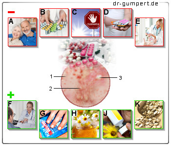 Schematische Darstellung von Hautausschlag nach Antibiotikaeinnahme