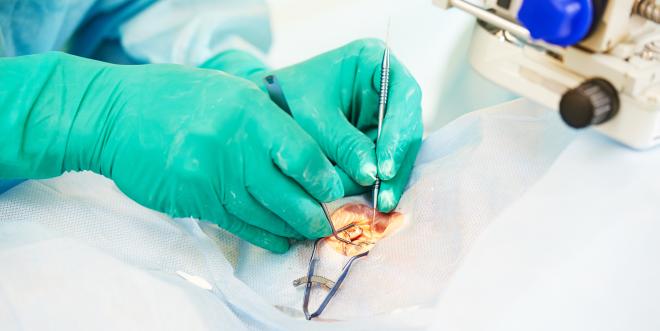 Operation der Ptosis Therapie der Ptosis