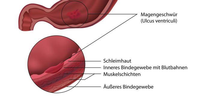 Darmschleimhaut, Schleimhaut, Magenwand, Darm