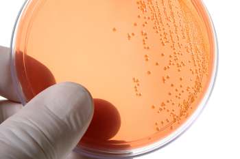 Borreliose Test Petrischale