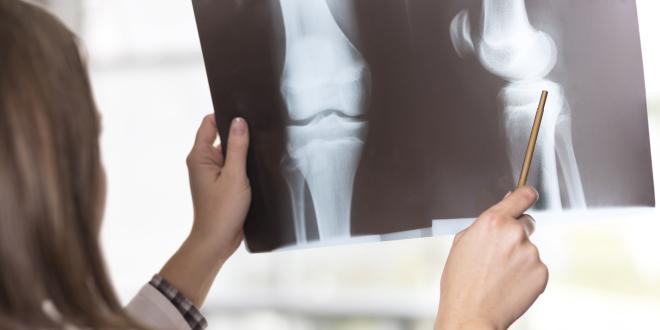 Nicht Ossifizierendes Fibrom